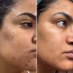 Brighten_complexion